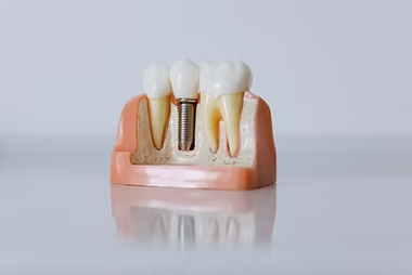 Endodontia